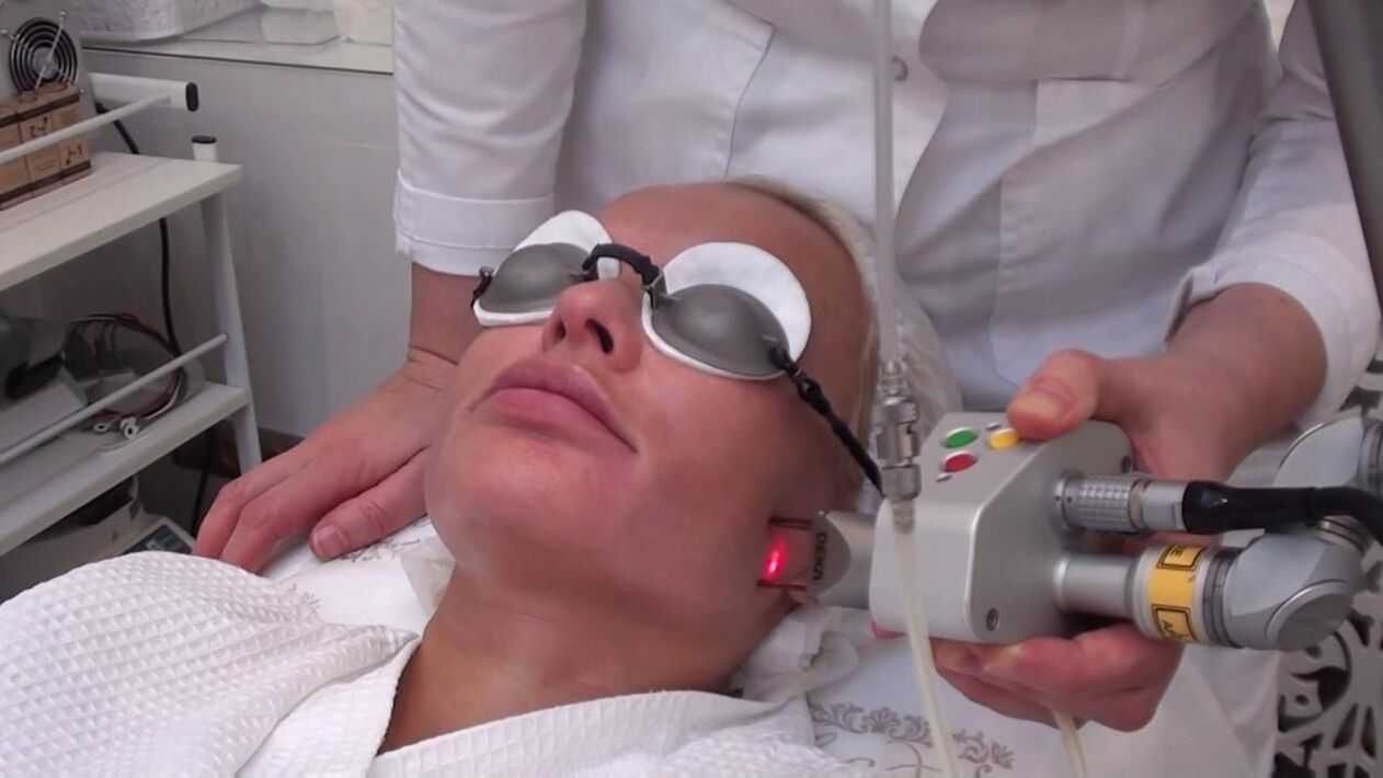 Третман ласерским зраком проблематичних подручја коже лица
